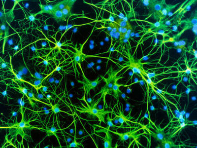神经退行性疾病的干细胞治疗