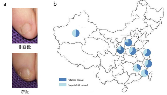 中国科学院上海营养与健康研究院科研人员发现跰趾特征非汉族群体所独有