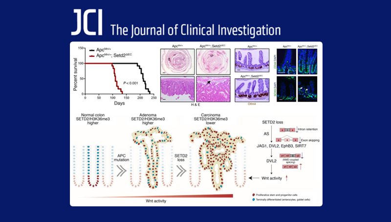 中国科学院上海营养与健康研究院科研人员揭示组蛋白H3K36三甲基转移酶SETD2在肠癌中的重要功能及调控机制