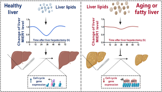 营养与健康所丁秋蓉研究组发现肝脏再生过程中肝脏脂质动态变化信号转变为再生修复信号的关键“桥梁”因子