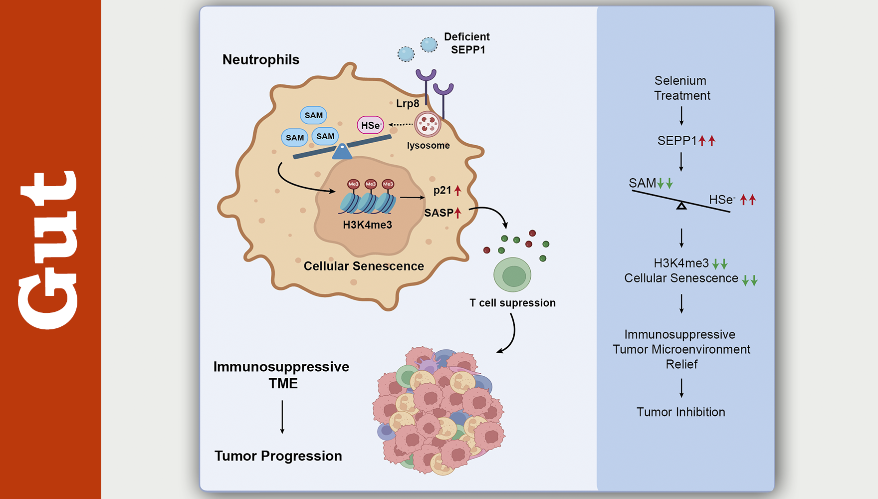 营养与健康所詹丽杏研究组合作揭示硒代谢异常诱导中性粒细胞衰老并重塑肝癌免疫微环境的新机制